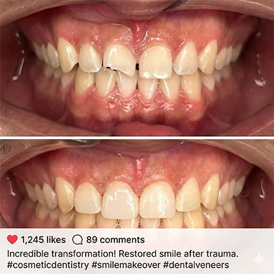 A stunning before and after dental procedure showcasing a patient's new smile